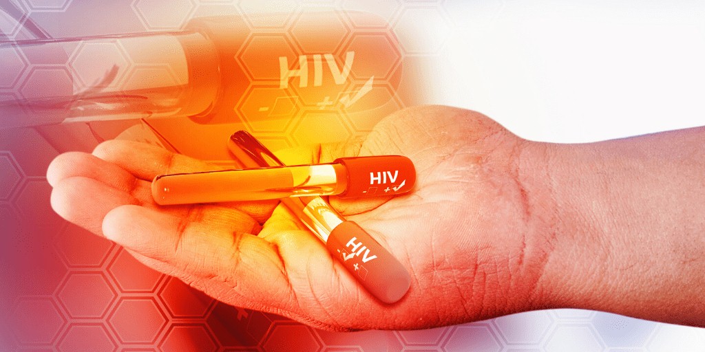 اهمیت پیشگیری از راه های انتقال ایدز